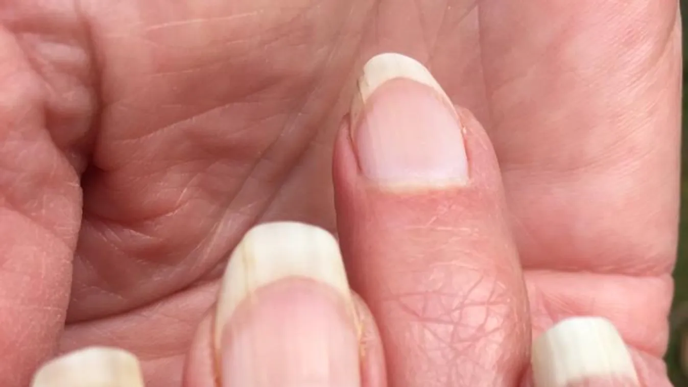 Ez a 10 pont mutatja kézfejünkön a koronavírus-fertőzést