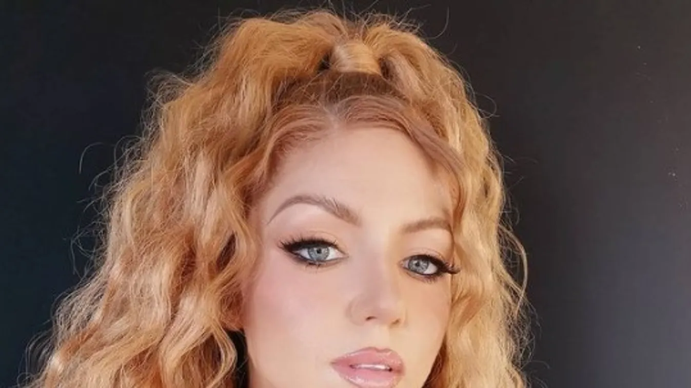 Fotó bizonyítja, plasztikai sebésznél járt Tolvai Reni