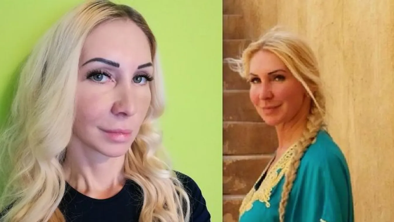 Újra meg kellett műteni a brutálisan összevert Orosz Bernadettet: tovább romlott az állapota