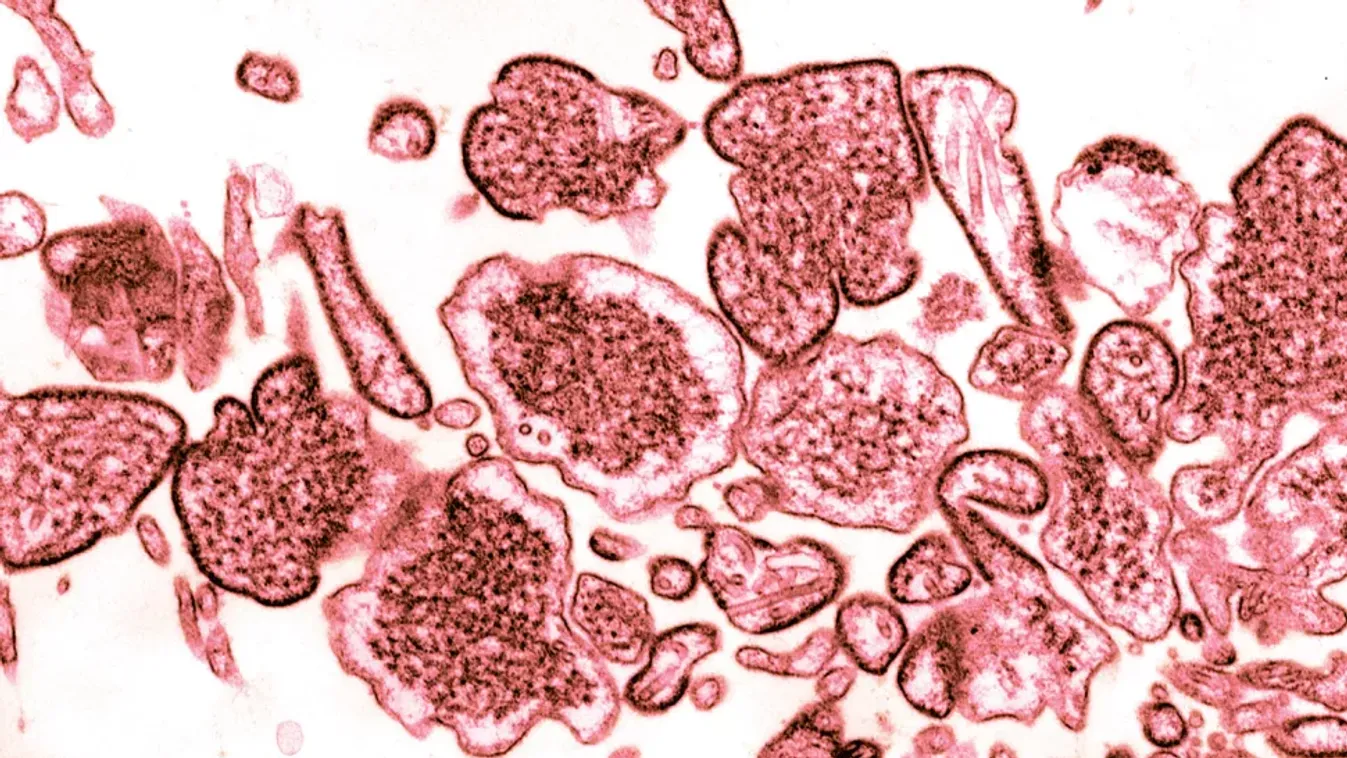 Nipah-vírus: Újabb, emberre veszélyes kórokozót mutattak ki denevérekben