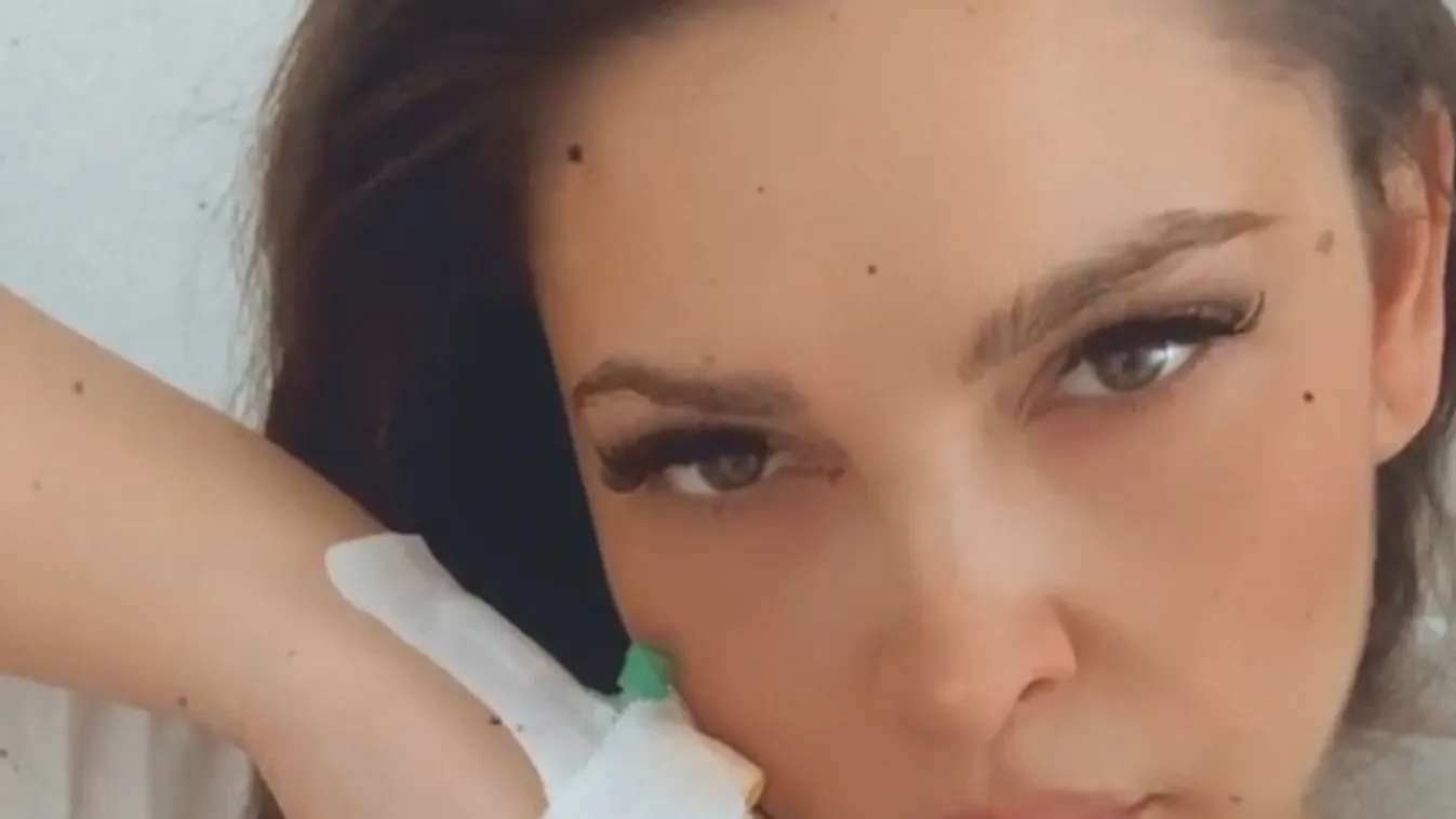 Komoly műtéten van túl a magyar rapper párja, így érzi magát