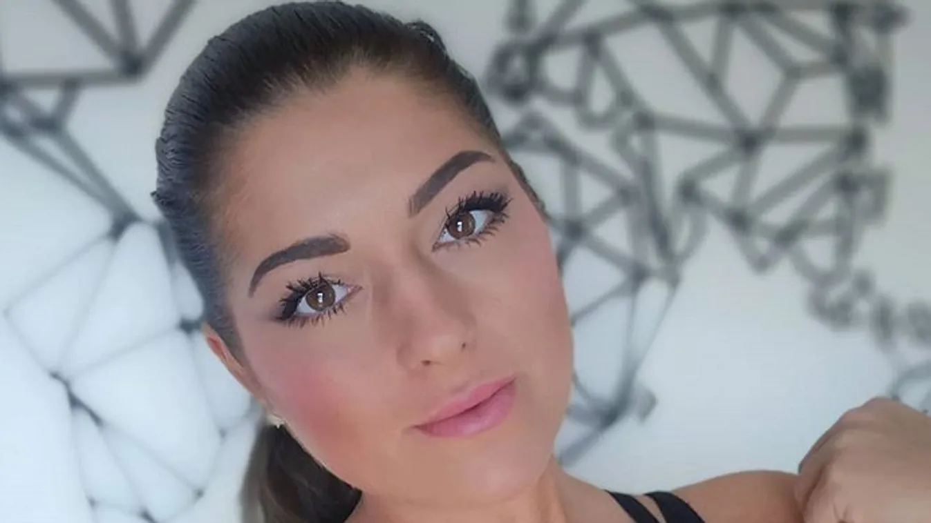 Csúnya sebek borítják a TV2 egykori sztárjának testét