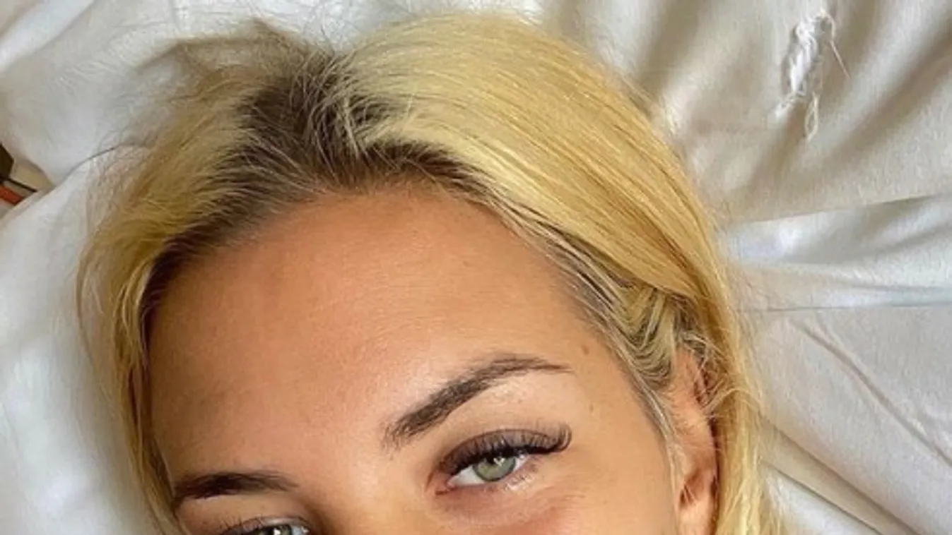 Túl van a műtéten az Exatlon sztárja - Fotó