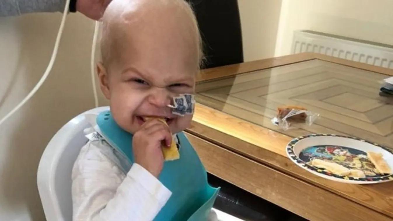 Fülgyulladásnak hitték: most az életéért küzd a 2 éves kisfiú