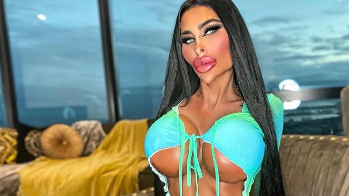 Óriási mellel, feltöltött szájjal és szilikonfenékkel dolgozik a klinikán ez a nővér - Fotó