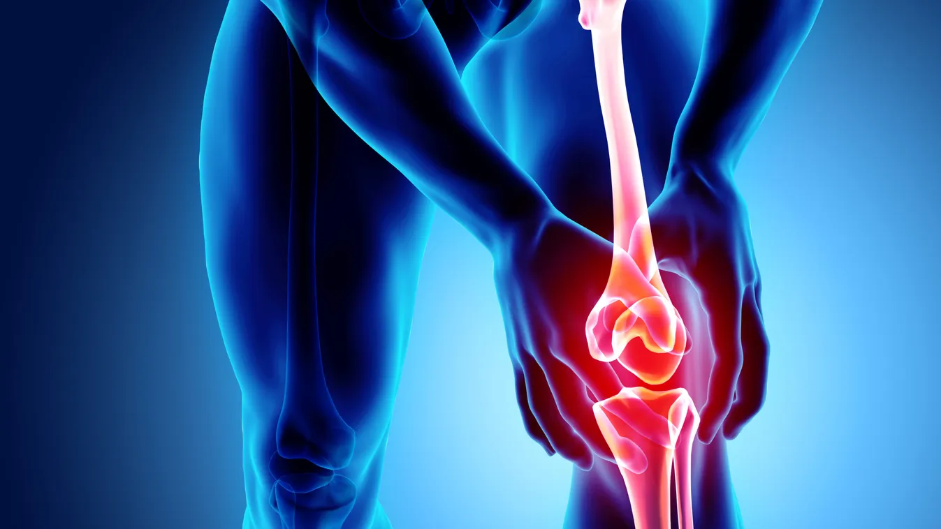 Durva, de ezek az ételek teszik tönkre az ízületeidet