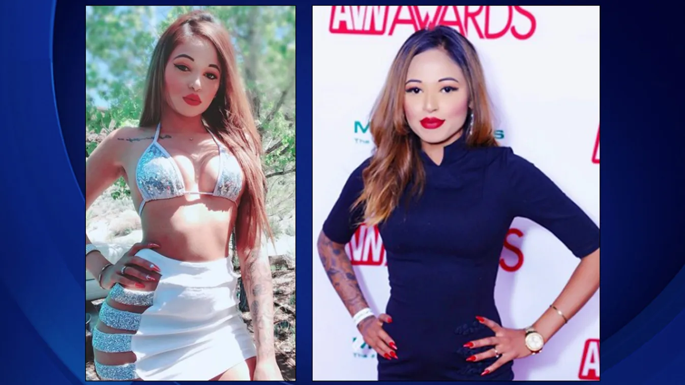 Álorvosok töltötték fel a pornósztár fenekét, belehalt a műtétbe