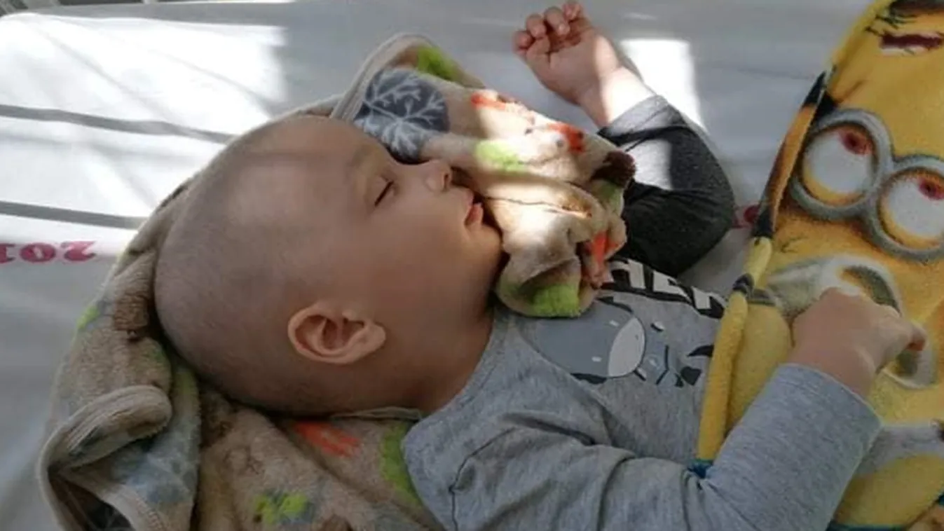 Szülők rémálma: Ádám 2 évesen élet-halál harcot vív betegségével, ezekkel a tünetekkel kezdődött