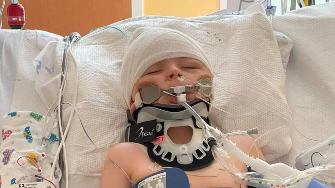 Élet és halál között lebeg egy 6 éves kisfiú, miután eltalálta egy acéldarab