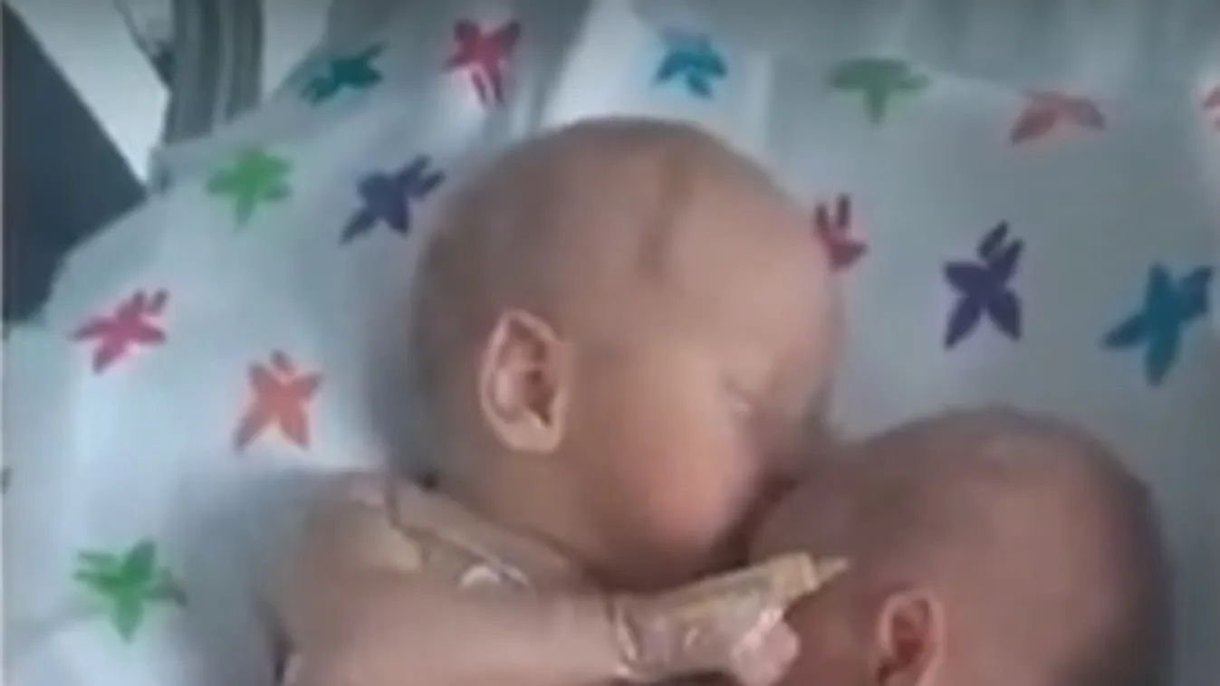 A skót házaspár minden nap 174 mérföldet tesz meg, hogy meglátogassa a kórházban újszülött ikreit