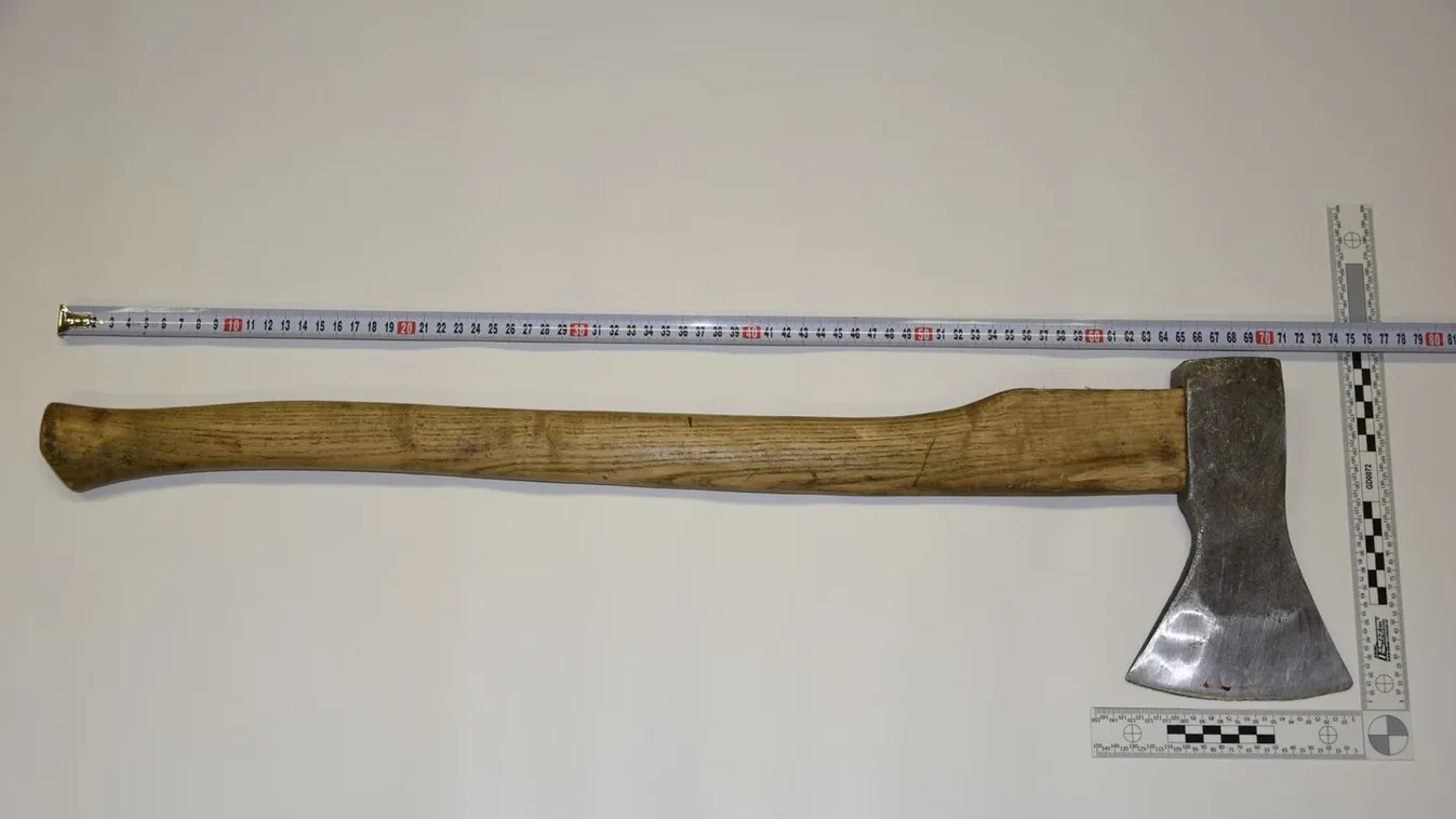 Nincsenek szavak: túlélte a nő, hogy belevágtak egy fejszét a fejébe