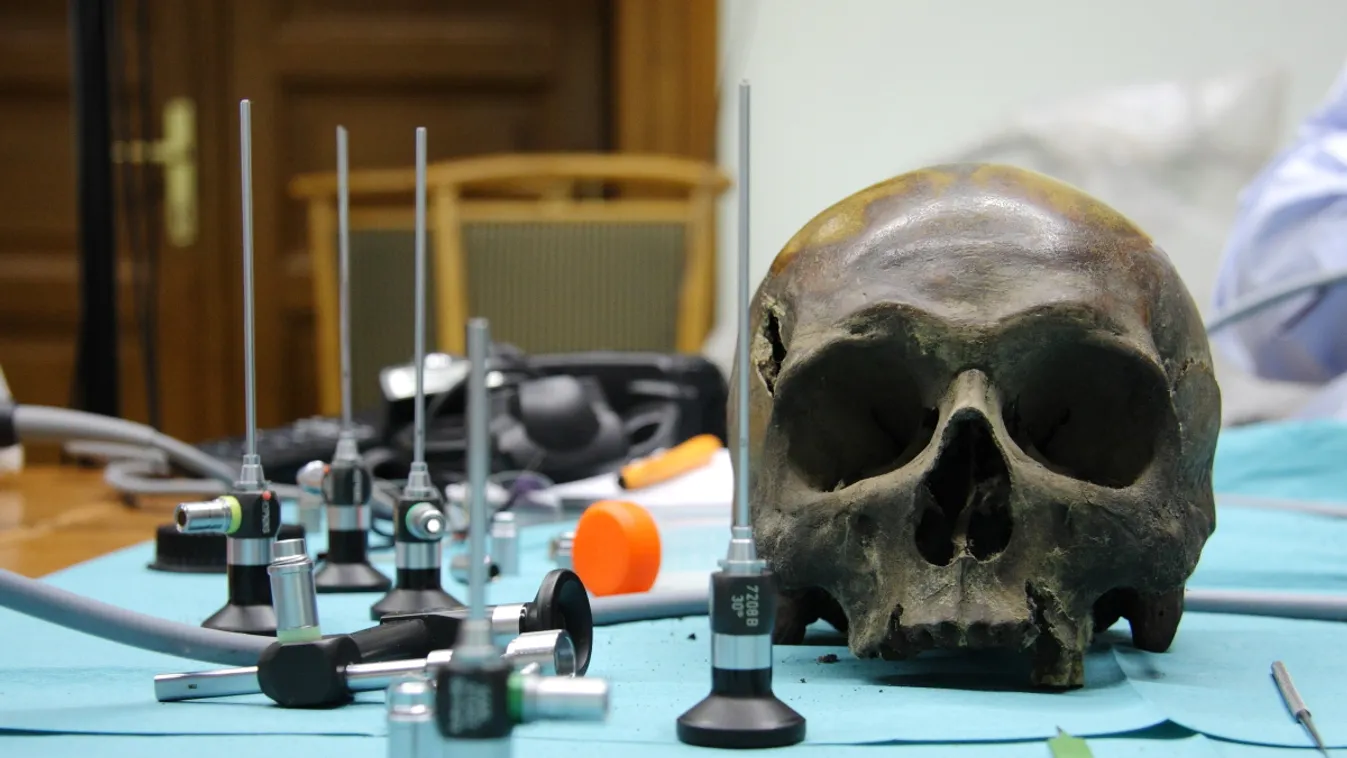 Ezzel a módszerrel vizsgálják Szent László koponyáját