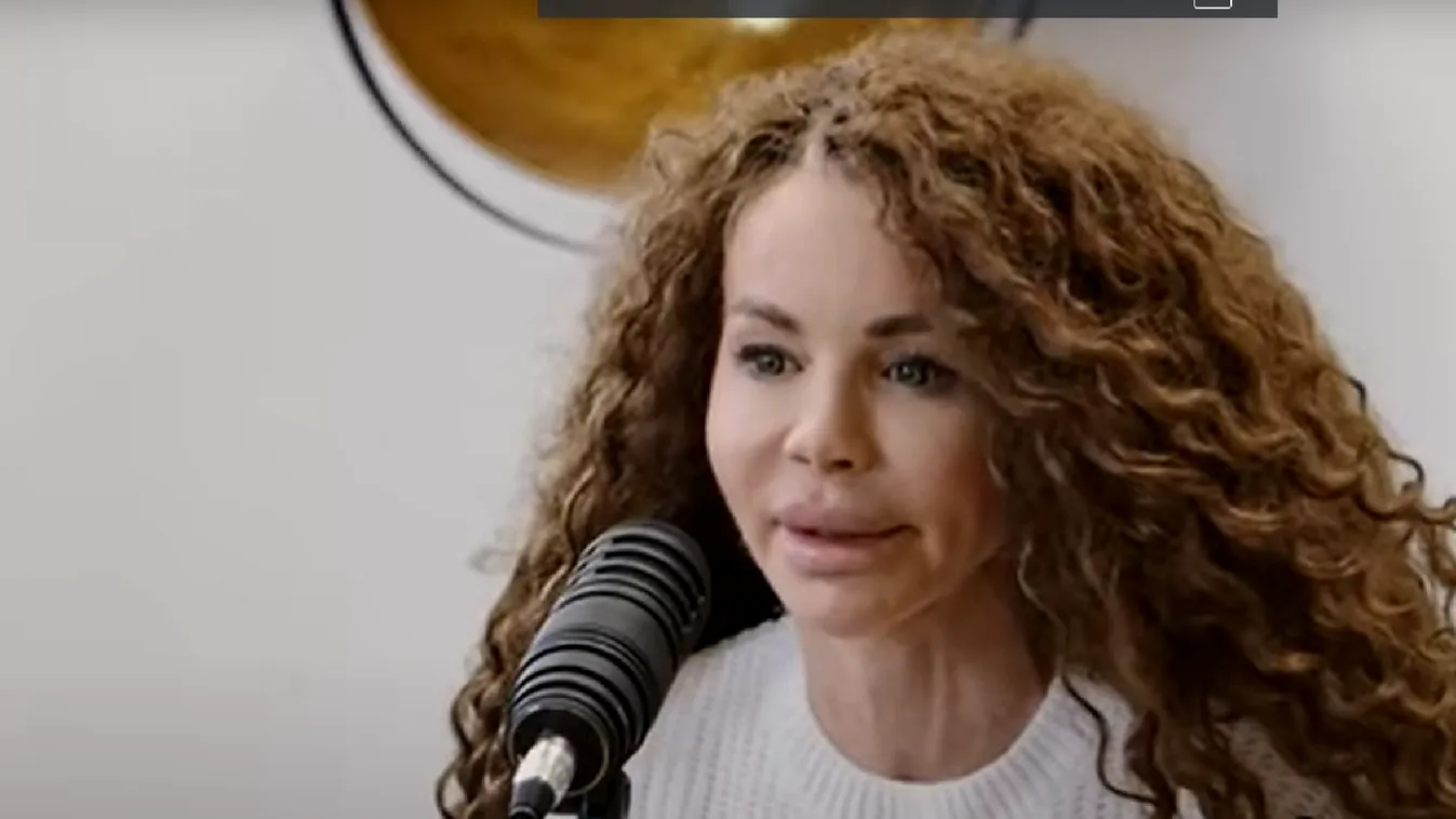 Felismerhetetlenné plasztikáztatta magát Keleti Györgyi – Fotó