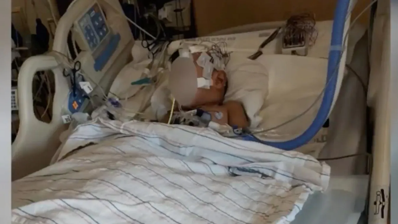 Minden lélegzetéért megküzd a 4 éves kisfiú, aki kómába került