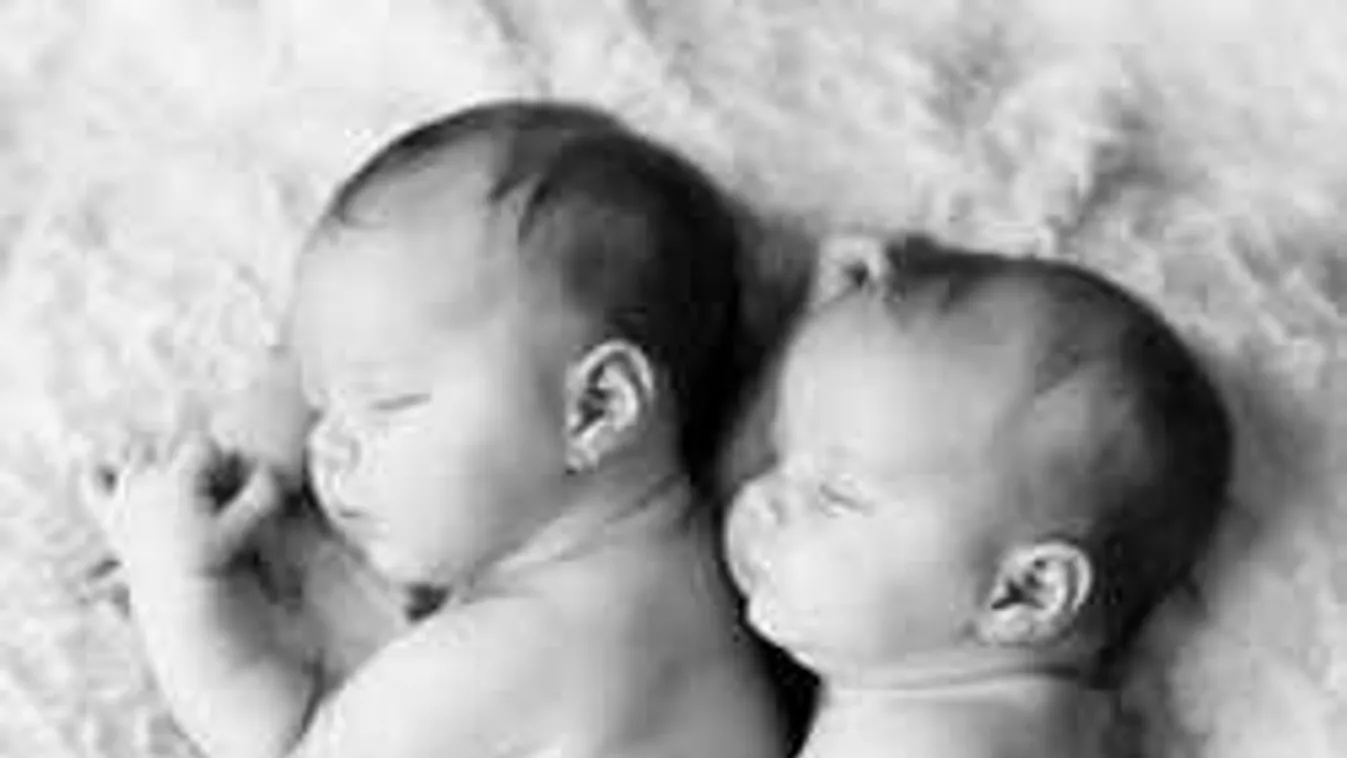 Óriási meglepetés a szülőszobán: különböző bőrszínű ikrek születtek