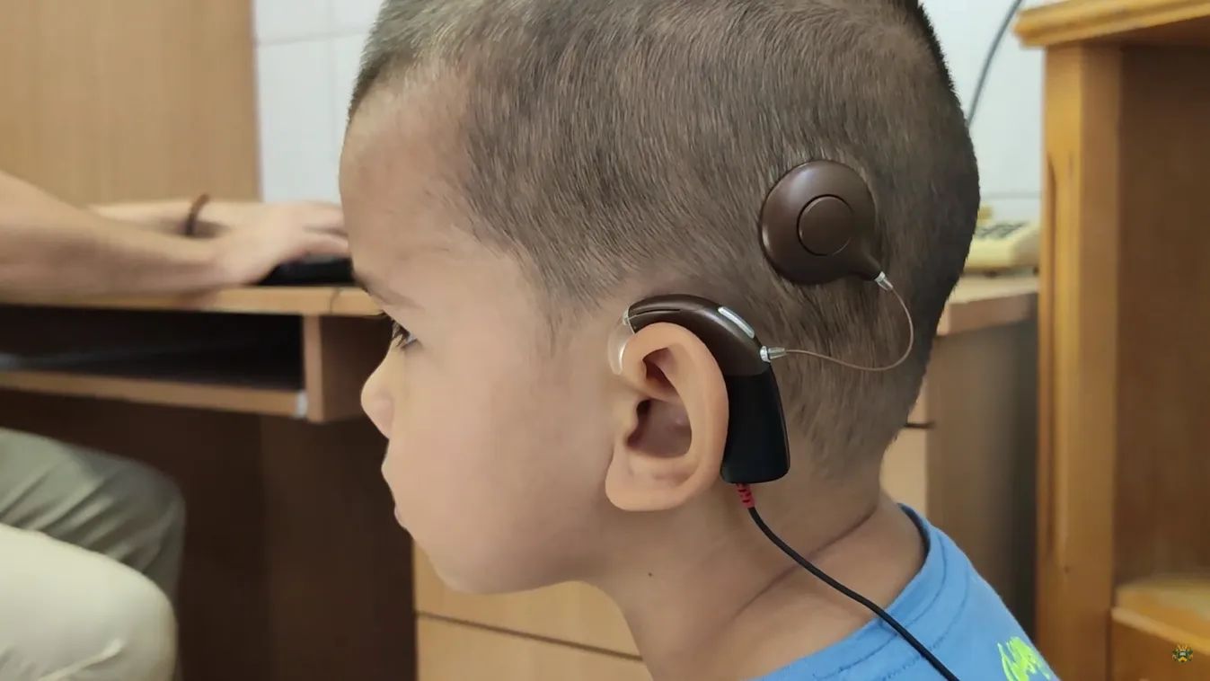 Orvosi bravúr: debreceni siket kisfiúk hallását adták vissza
