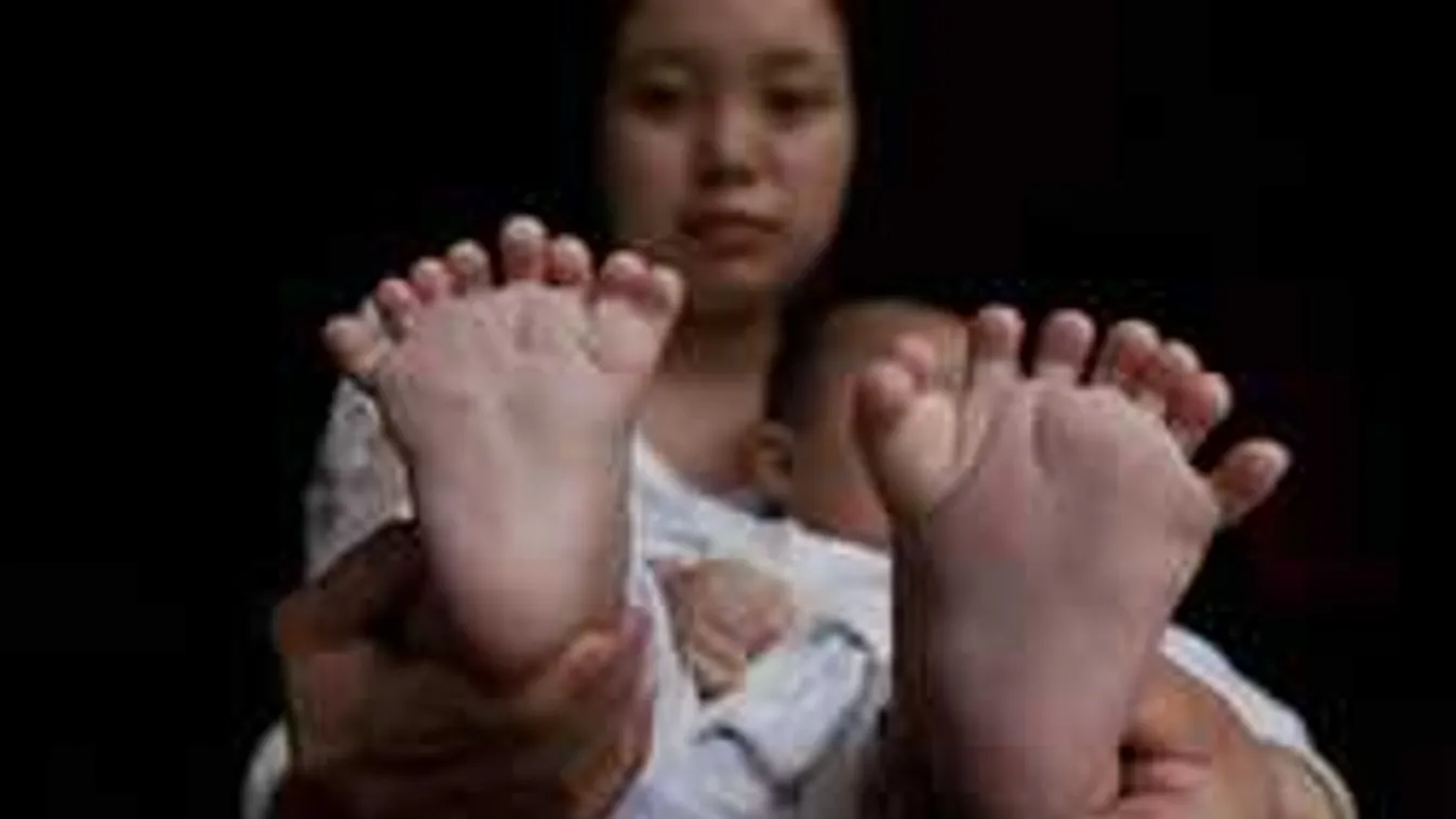 Megdöbbentek az orvosok, amikor meglátták a kisfiút