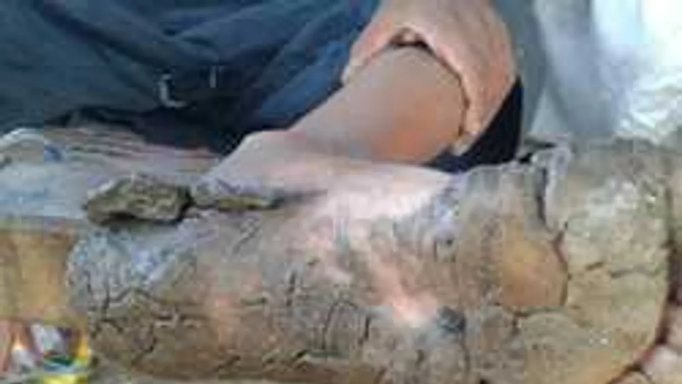 Megrázó fotók, így élnek a kővé vált végtagú testvérek