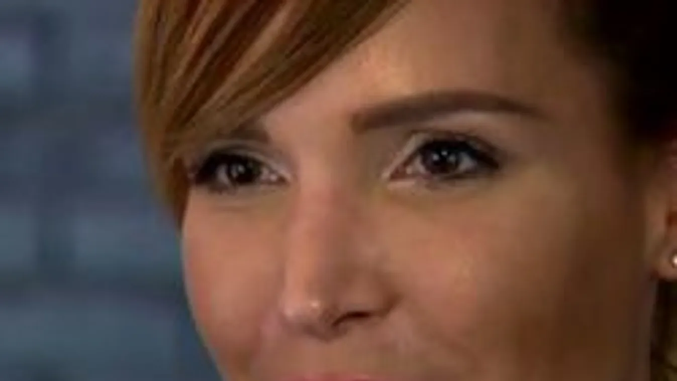 Milliókat költött plasztikára Zimány Linda