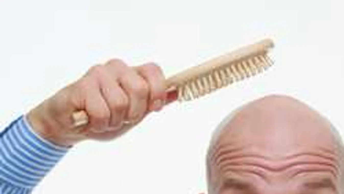 A kopaszodás elkerülhető, mutatjuk, mit kell tenni