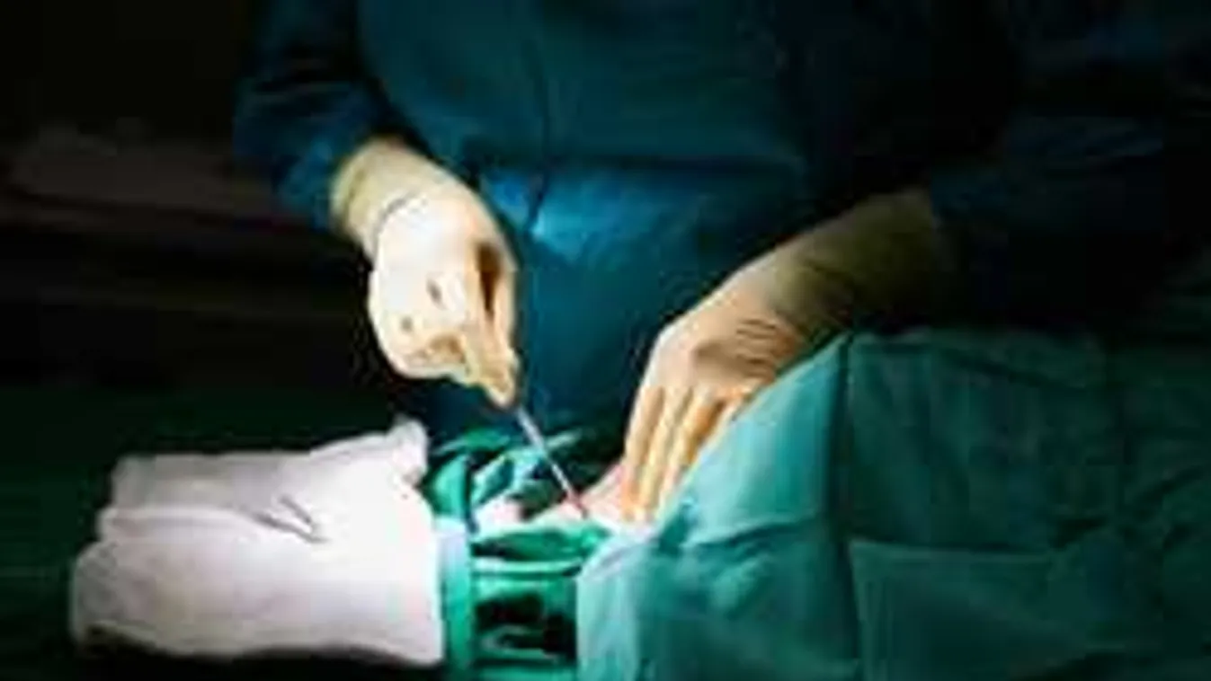 Kínzó panasszal ment orvoshoz, szokatlan tárgy volt a férfi fejében