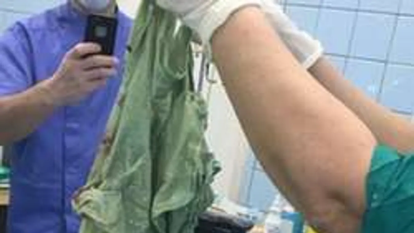 Döbbenet: Háromméteres lepedőt felejtettek a kismama méhében