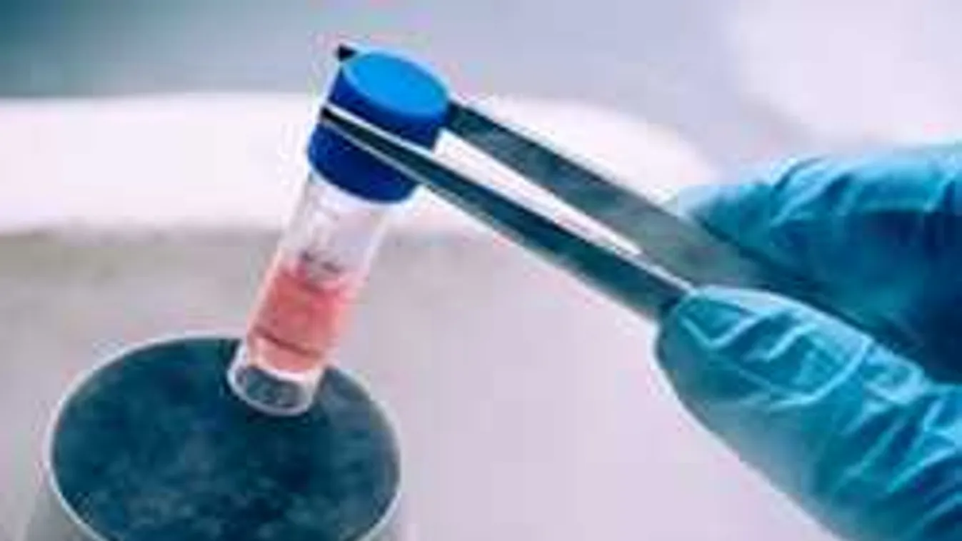 Megtudtunk mindent a lombikprogram legnagyobb dilemmájáról