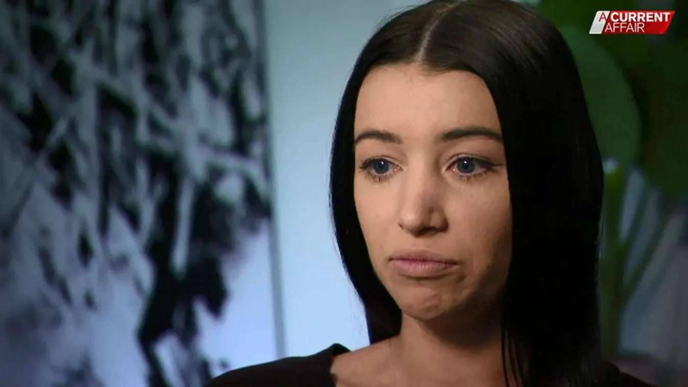 Felrobbant egy nő szája az ajakfeltöltés után, csoda, hogy túlélte