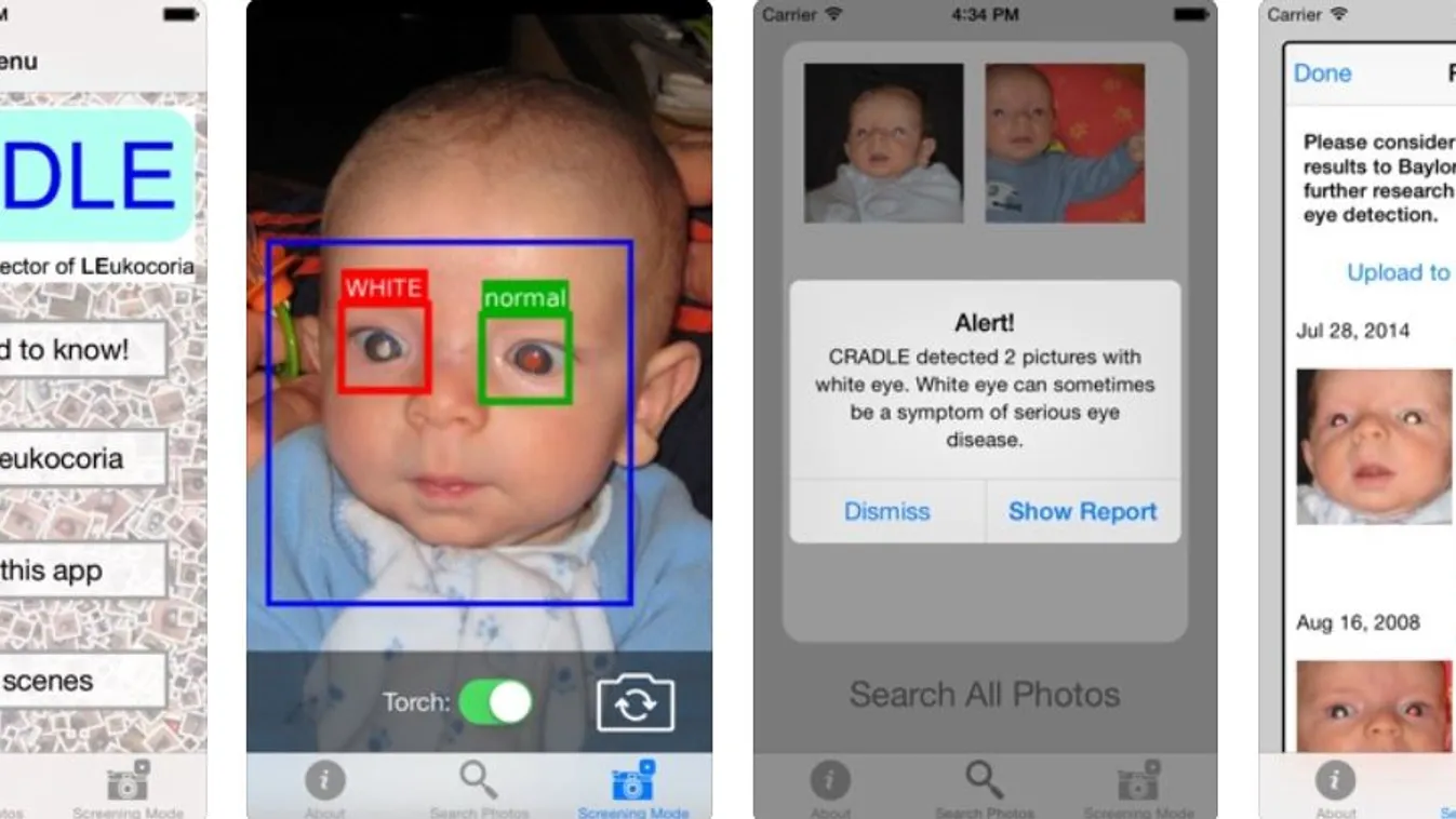 Komoly szembetegségeket tud kiszűrni ez a mobilos alkalmazás
