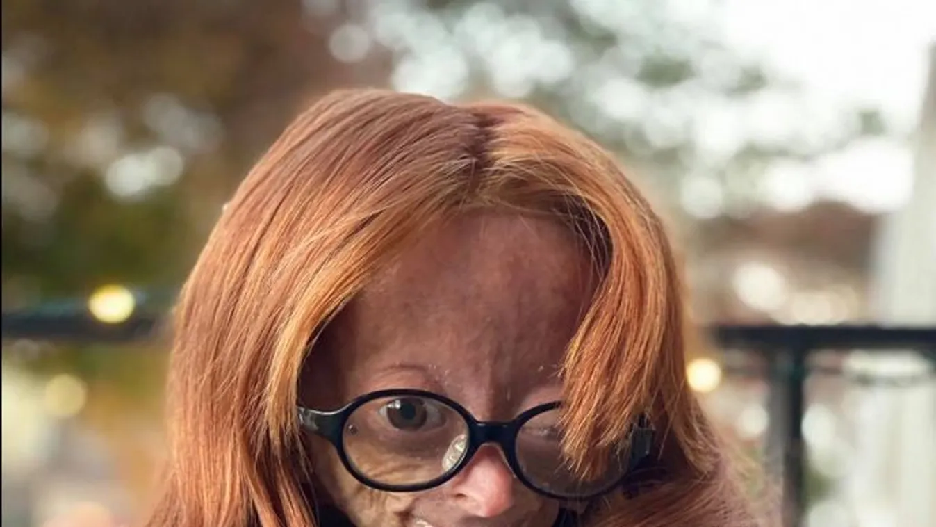 Elhunyt a tragikus sorsú 15 éves YouTube-sztár. Igazi példa volt az élete