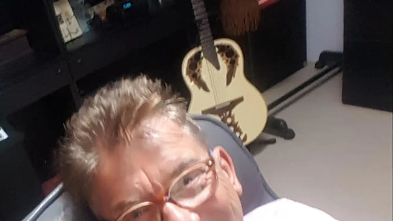 Véres beavatkozás, ezt varratta magára a magyar énekes