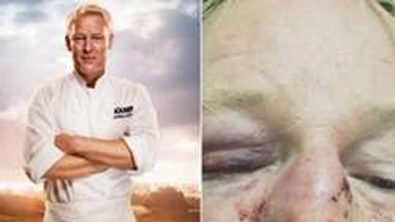 Brutálisan megvert egy svédet három muszlim, mert hasonlít Trumpra...