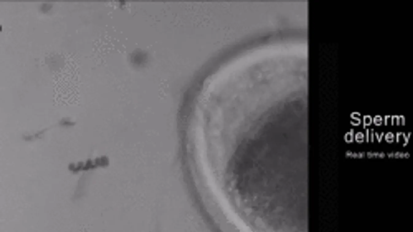 Meglepő területen állítja hadrendbe a spermiumokat a tudomány!