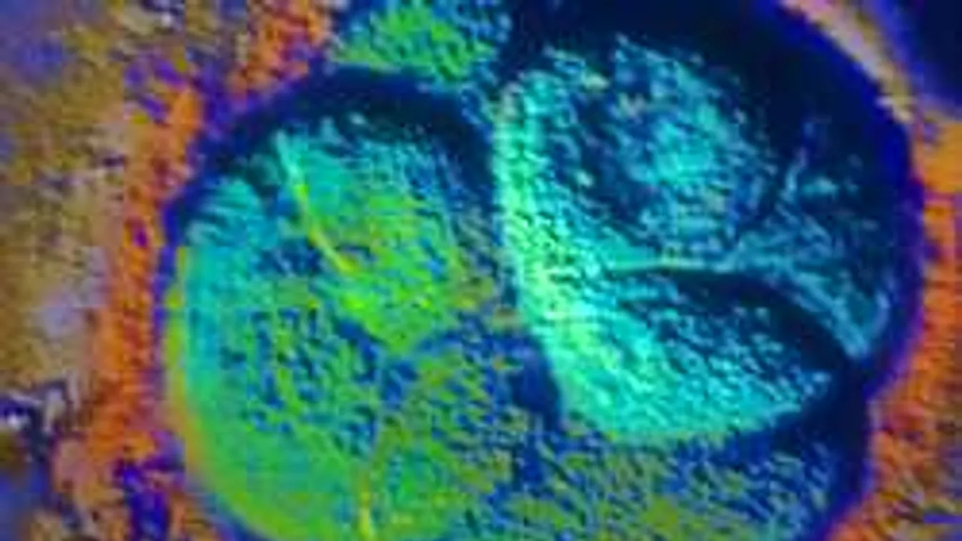 Hihetetlen, ez történt a magyar nővel, mert eladta a petesejtjeit