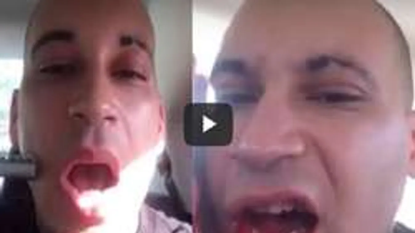 Durva: arcon lőtte magát a rapper, hogy híressé váljon! Sokkoló videó!