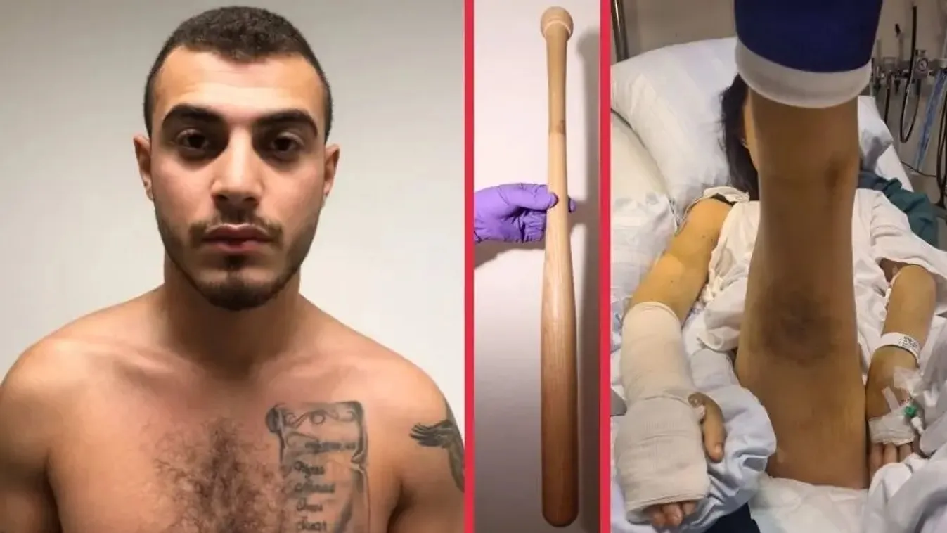 Egy libanoni migráns baseballütővel félholtra verte a svéd barátnőjét, mert találkozott valakivel