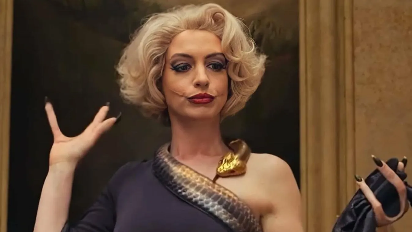 Anne Hathaway általában gyönyörű, de a legújabb fotójától rémálmaid lesznek