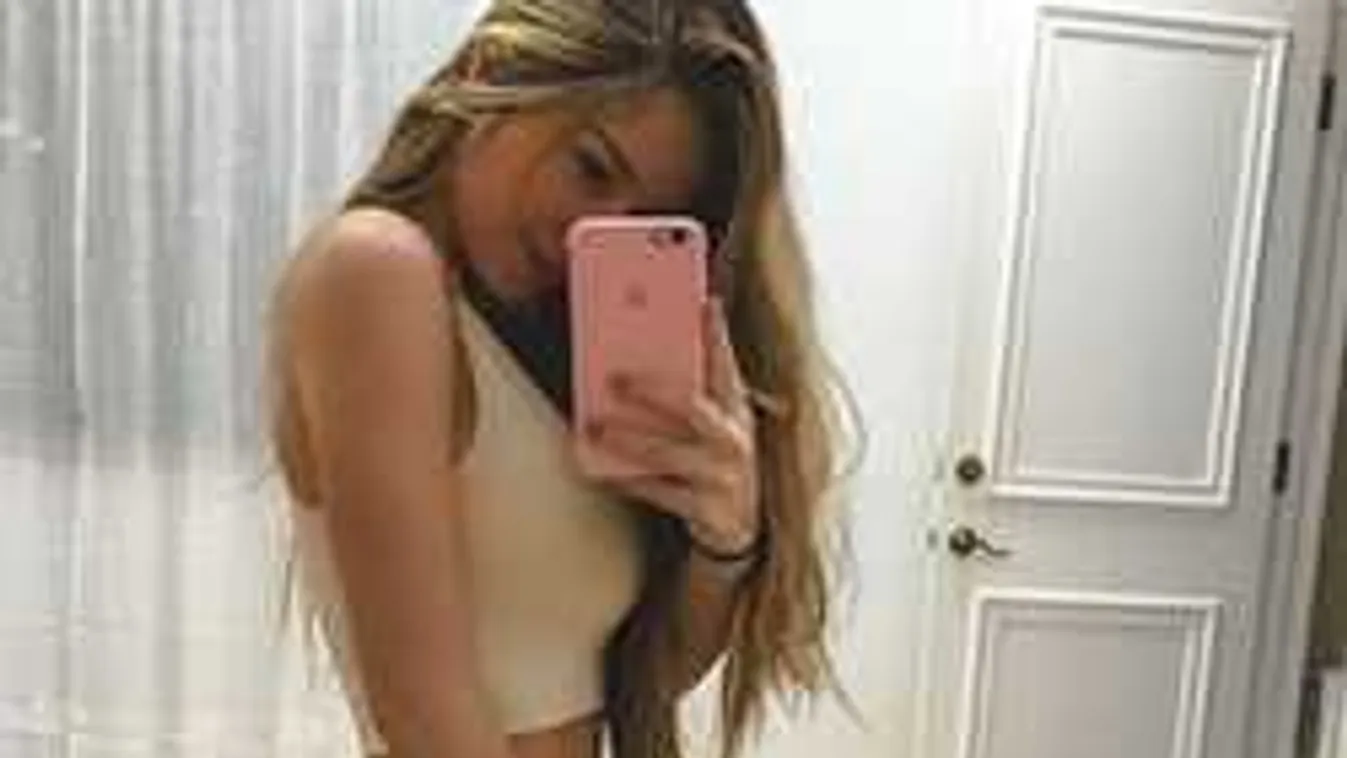 Ebben a durva betegségben szenvedhetnek azok, akik folyton szelfiznek