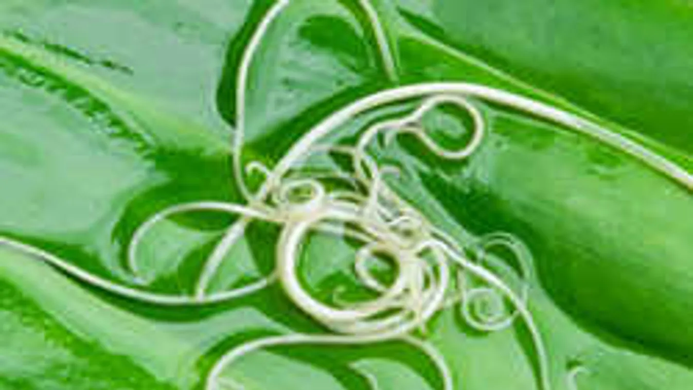 Egy féreg növekedett a férfi agyában, az orvosa véletlenül vette észre