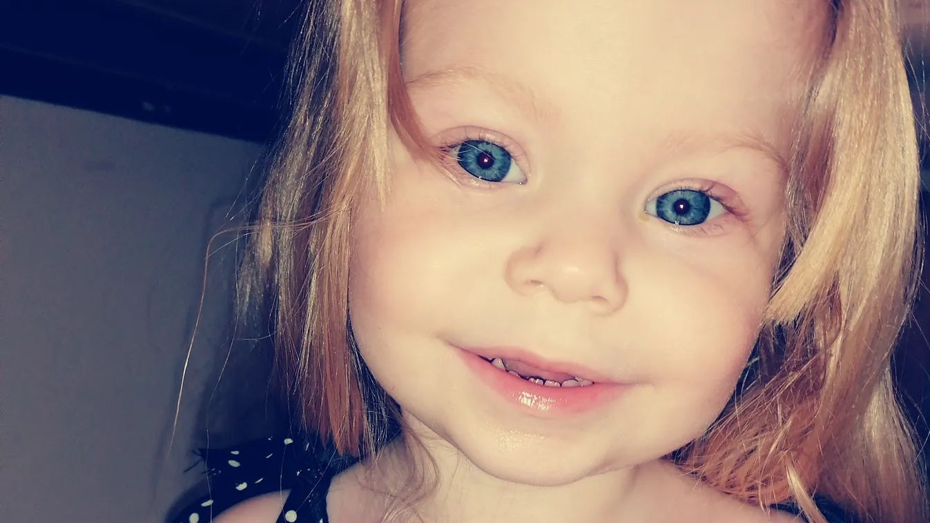 Az orvosok már lemondtak róla: két szívműtét után is mosolyog az angyalarcú kislány