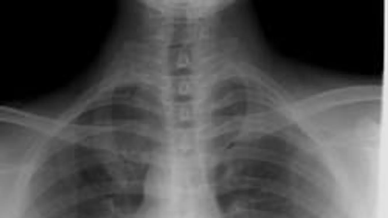 Börtönből kapja a pénzt a súlyos beteg magyar lány