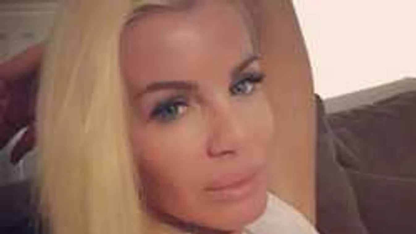 Mit műveltek Keleti Györgyi arcával? Felismerhetetlen lett