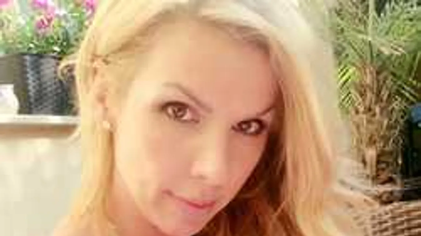 Megműtötték a magyar sztáranyuka arcát: itt az első fotó