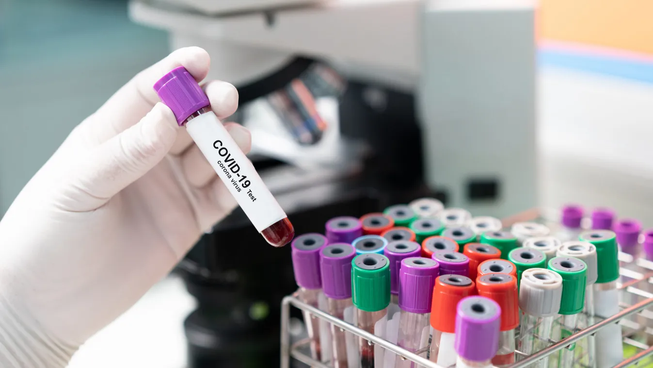 Coronavirus,Covid,19,Infected,Blood,Sample,In,Sample,Tube,In