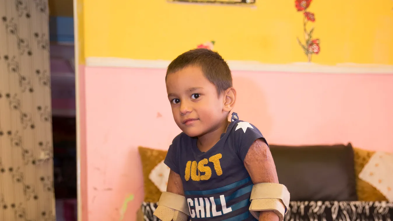 Összeszorul a szív: műlábra gyűjt az amputált kisfiú