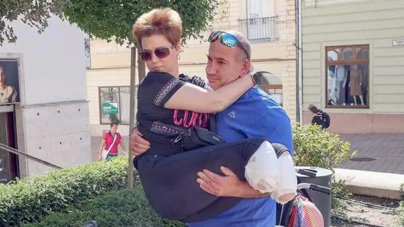 Kevesebb mint egy hónap alatt három végtagját is elvesztette a nő – erre kér most segítséget