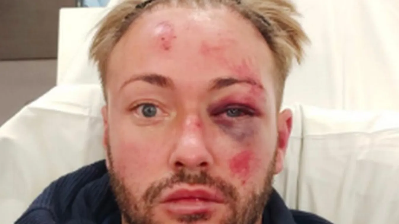 „Könyörögtem nekik, hogy hagyják abba„ – egy csapat fiatal szinte halálra vert egy férfit – sokkoló fotók