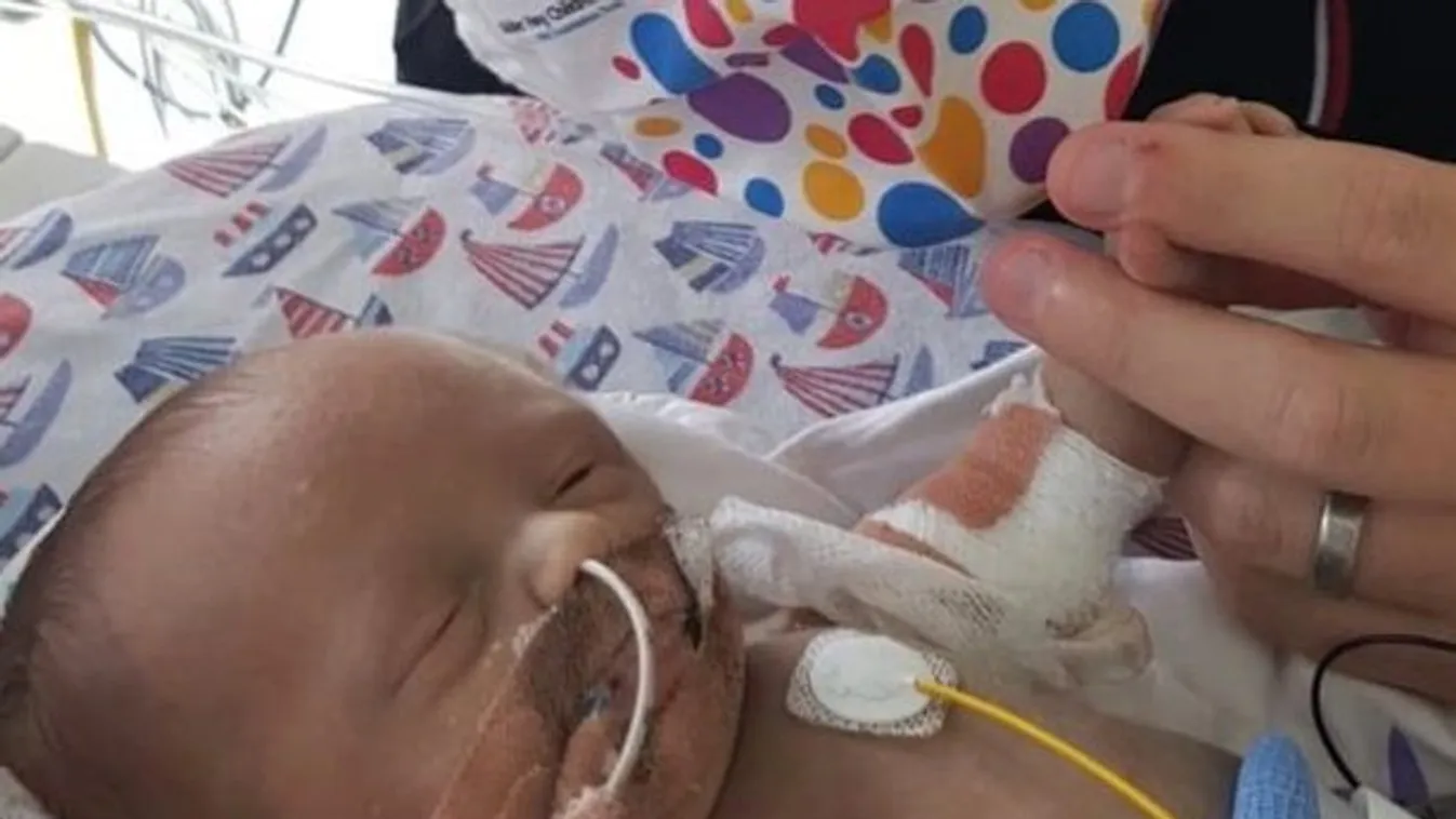 Ömlött a vér a koraszülött baba testéből, szörnyű, ami ezután történt