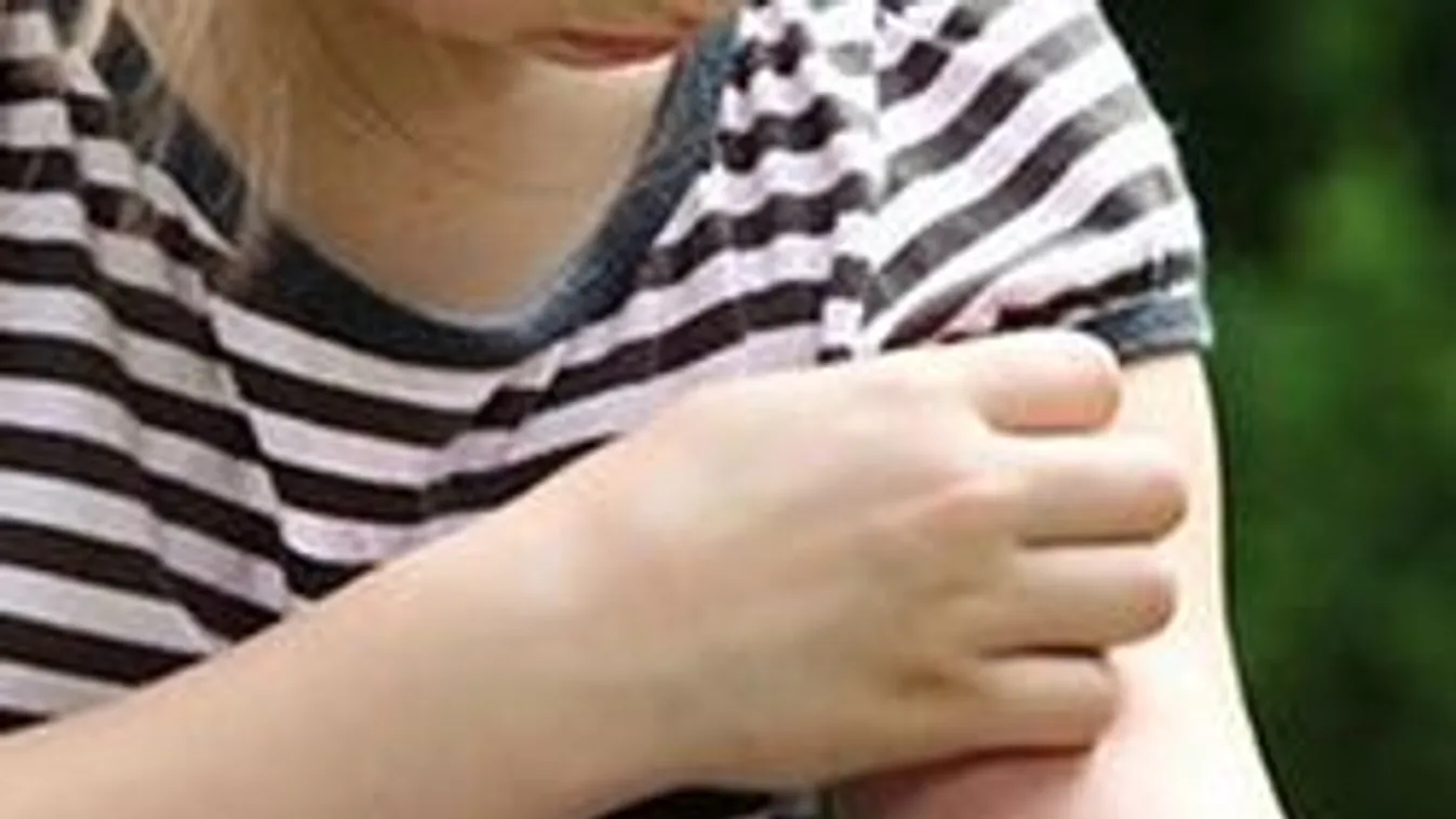 Ne kend a gyereket vegyszerrel! Készíts szúnyogriasztó krémet otthon!