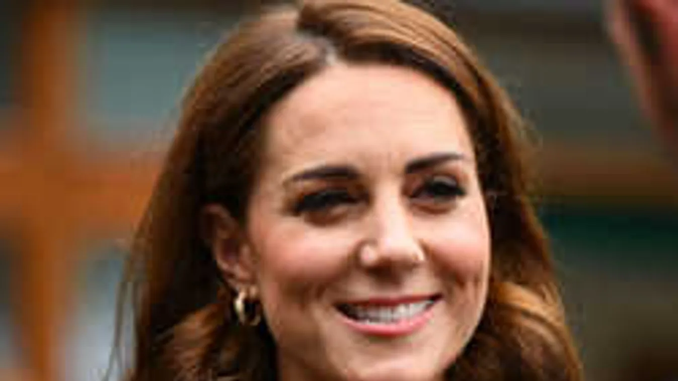 Teljesen megváltozott Katalin hercegné arca: a palota is megszólalt az ügyben